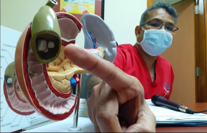 Advanced Laparoscopic Surgeon Dr Yardesh Singh shows where in the gallbladder he removed a world record gallstone, at Southern Medical Clinic, San Fernando Kristian De Silva