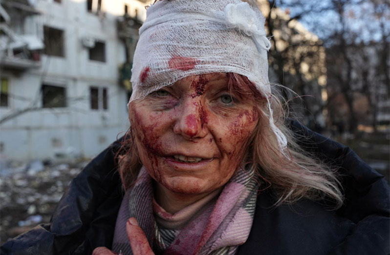 A wounded woman is seen after a reported airstrike at an apartment complex outside of Kharkiv, Ukraine, on February 24.Wolfgang Schwan/Anadolu Agency/Getty Images