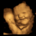 A 4D scan image of a fetus shows a laughter-face reaction after being exposed to the carrot flavor