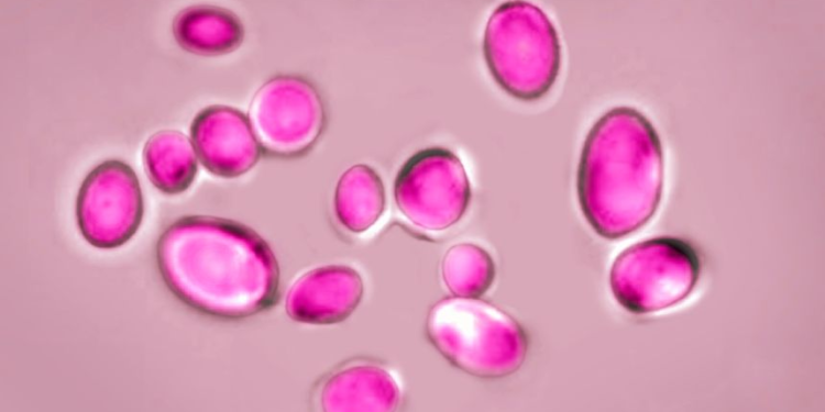 Candida auris, which often spreads in hospitals and has a mortality rate as high as 60%, was one of four species that the WHO designated as threats of the highest priority.