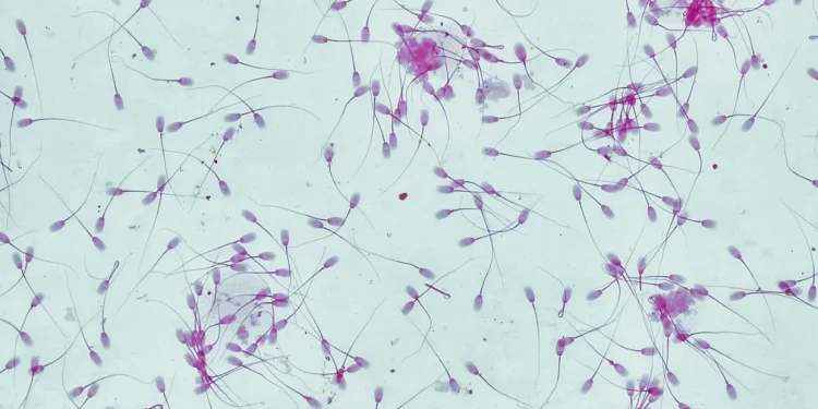 Sperm
