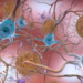 This illustration made available by the National Institute on Aging/National Institutes of Health depicts cells in an Alzheimer's-affected brain. An experimental drug modestly slowed the brain disease's progression, researchers reported Tuesday. NATIONAL INSTITUTE ON AGING, NIH/AP