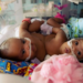 Amanda Arciniega and James Finley's conjoined twin daughters, JamieLynn and AimeeLynn, underwent separation surgery at Cook Children's Medical Center in Fort Worth, Texas. Courtesy of Cook Children's Medical Center