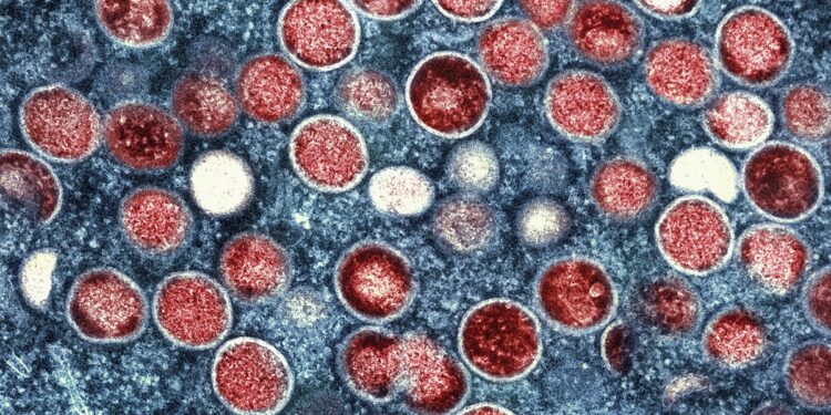 FILE - This image provided by the National Institute of Allergy and Infectious Diseases (NIAID) shows a colorized transmission electron micrograph of monkeypox particles (red) found within an infected cell (blue), cultured in the laboratory that was captured and color-enhanced at the NIAID Integrated Research Facility (IRF) in Fort Detrick, Md. The World Health Organization has renamed monkeypox as mpox, citing concerns the original name of the decades-old animal disease could be construed as discriminatory and racist. (NIAID via AP, File)