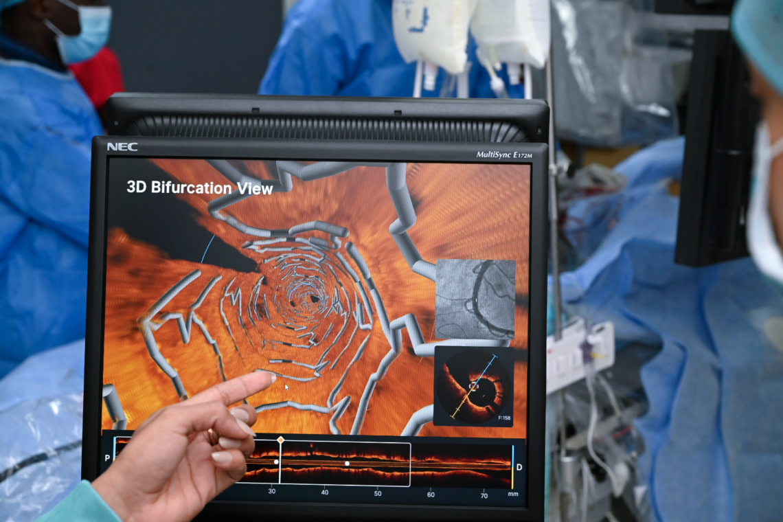 3D Image of Stent in Vessel