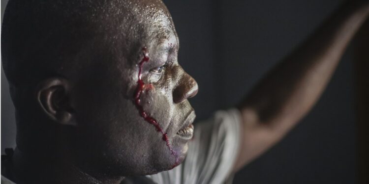 A wounded security officer looks on after being shot by armed gangs at the General Hospital in Port-au-Prince, Haiti, Tuesday, Dec. 24, 2024. (AP Photo/Jean Feguens Regala)