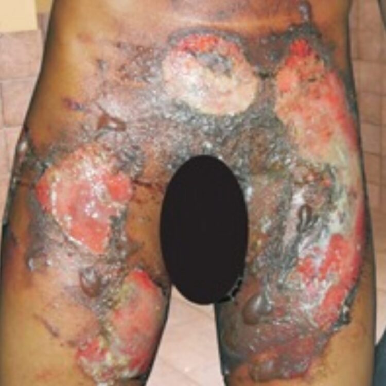 15-year-old Tywon Thomas who was tortured on October 28, 2009