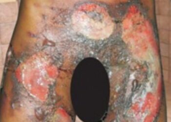 15-year-old Tywon Thomas who was tortured on October 28, 2009