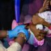 © UNICEF/Ahmed Mohamdeen Elfatih A baby receives a malaria vaccine in Sudan.