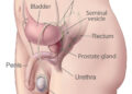 Prostate- Google photo