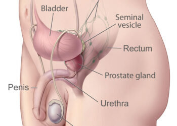 Prostate- Google photo