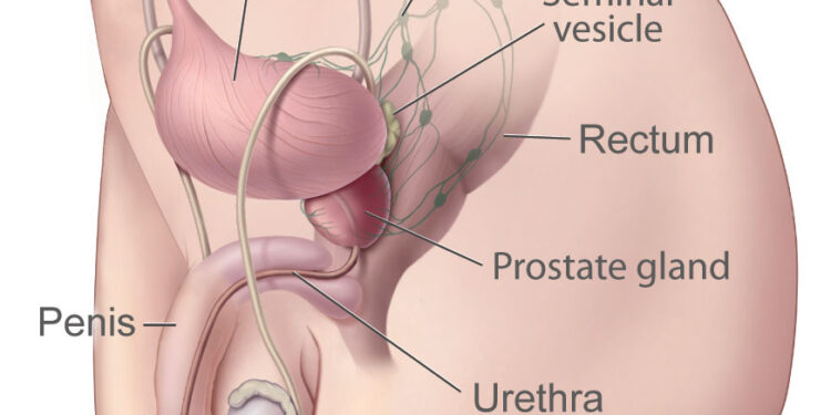 Prostate- Google photo